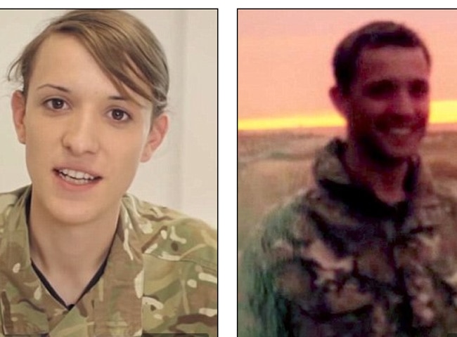 हन्नाह विंटरबर्न ऑपरेशन से पहले (दाएं) और बाद में (बाएं)