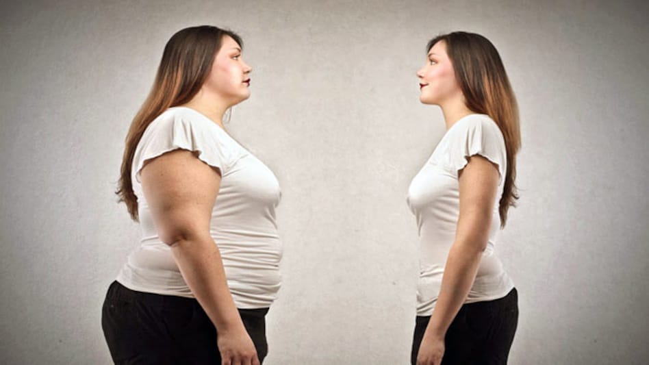 obesity : मोटापा दे सकता है कई गंभीर रोग, रहें सतर्क मोटापा कम करना हुआ आसान - reducing obesity is easy - AajTak