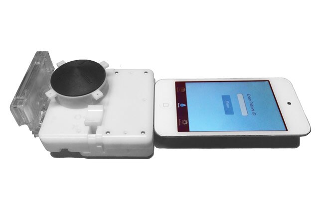 स्मार्टफोन बताएगा कि आप HIV पॉजिटिव हैं या नहीं