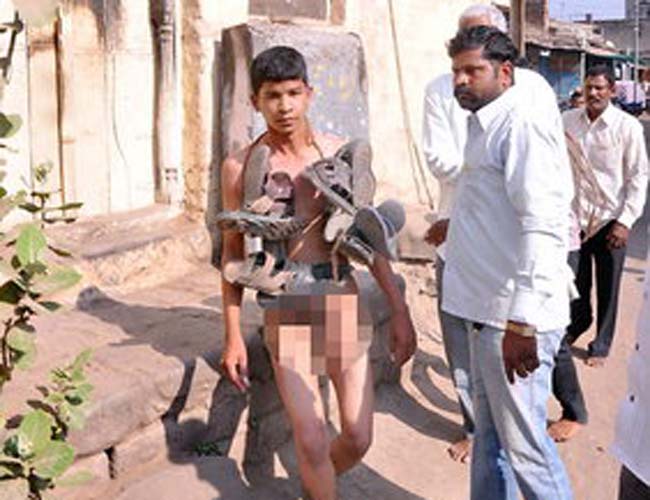 पीड़ि‍त लड़के की तस्वीर