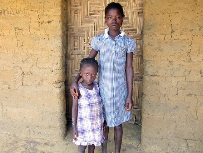 इबोला ने बढ़ाई मुसीबत