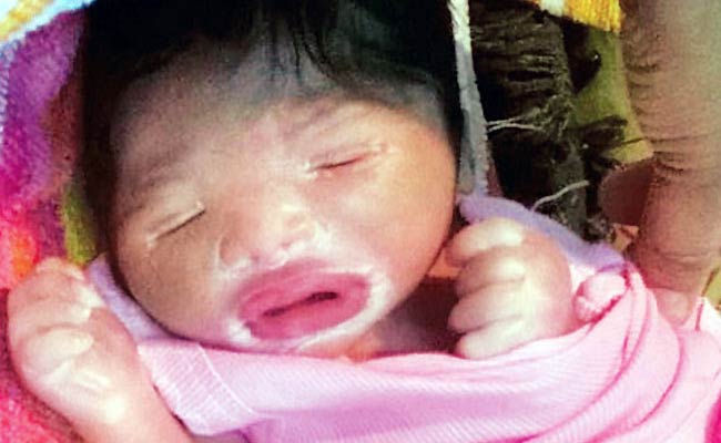 अमृतसर में जन्मी 'प्लास्टिक बेबी'