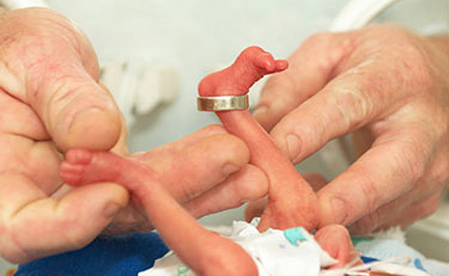 प्रतीकात्मक तस्वीर