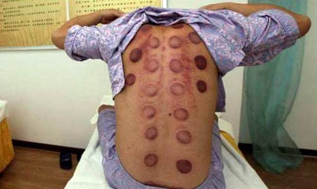 ये कैसी थेरेपी?