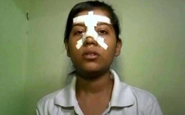 डॉली सिंह के चेहरे पर भी गंभीर चोटें आई हैं