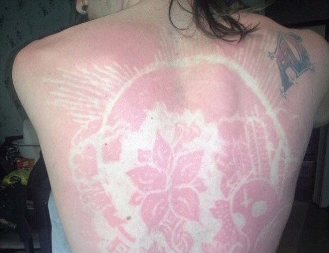 sunburn art