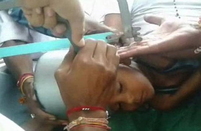 खेलते समय फंसा बच्चे का सिर