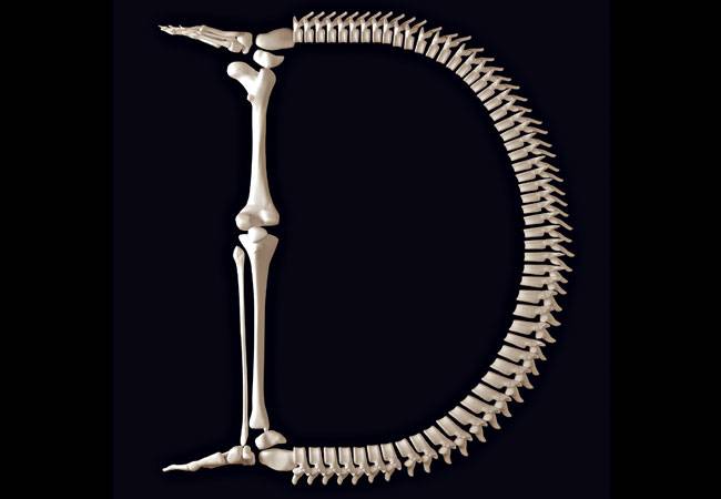 विटामिन डी की कमी से चटकती हडि्डयां