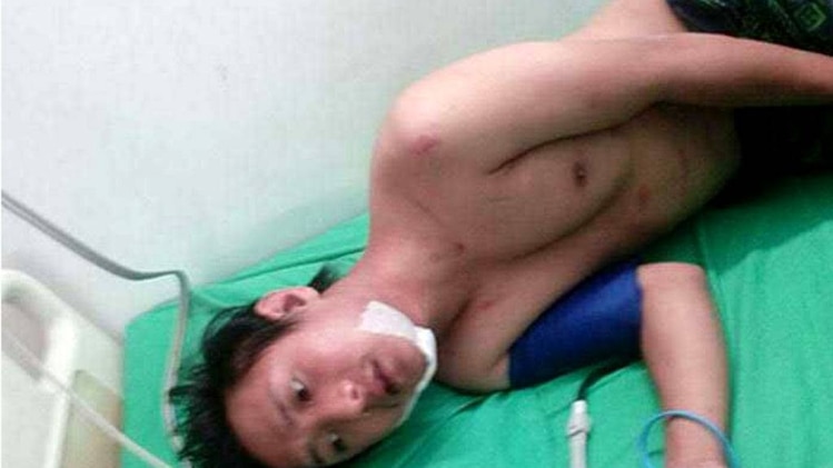 यही है वो छात्र जिसे मकान मालिक ने पीटा है..