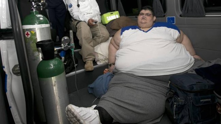 गैस्ट्रिक बाईपास सर्जरी की गई है.