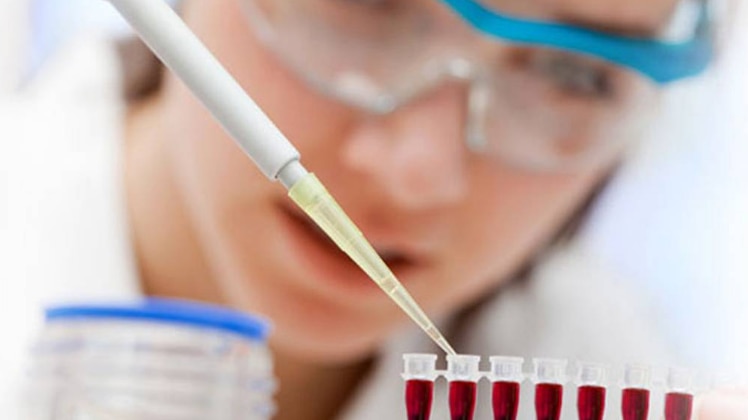 अब पांच साल पहले पता चल जाएगा 'कैंसर', कराना होगा एक 'ब्लड टेस्ट' - blood test may diagnose brain cancer five years early - AajTak