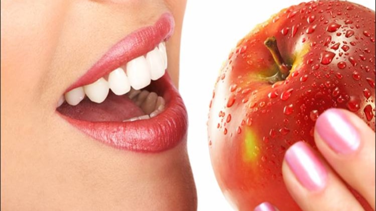 Representational photo