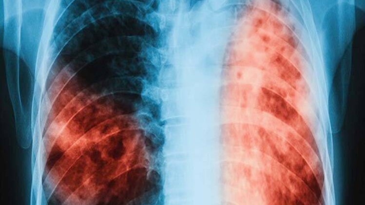 प्रतीकात्मक फोटो