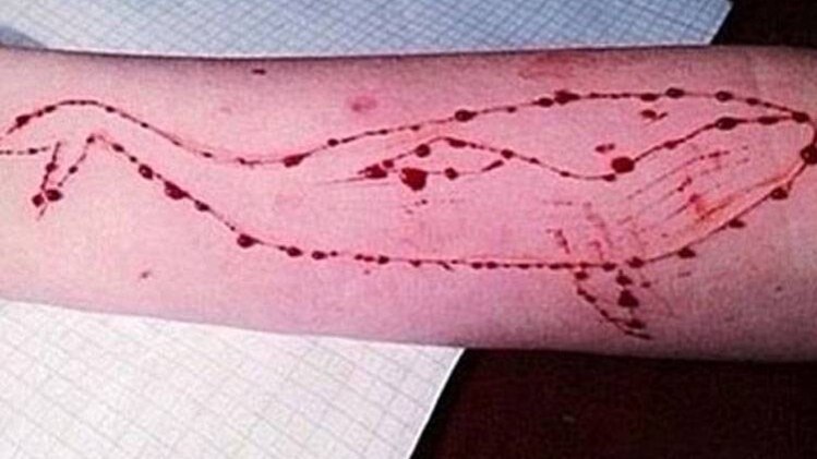 वायरल टेस्ट