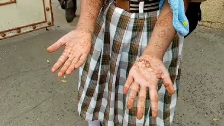 महेंदी लगाकर स्कूल पहुंची छात्राओं को रोका गया