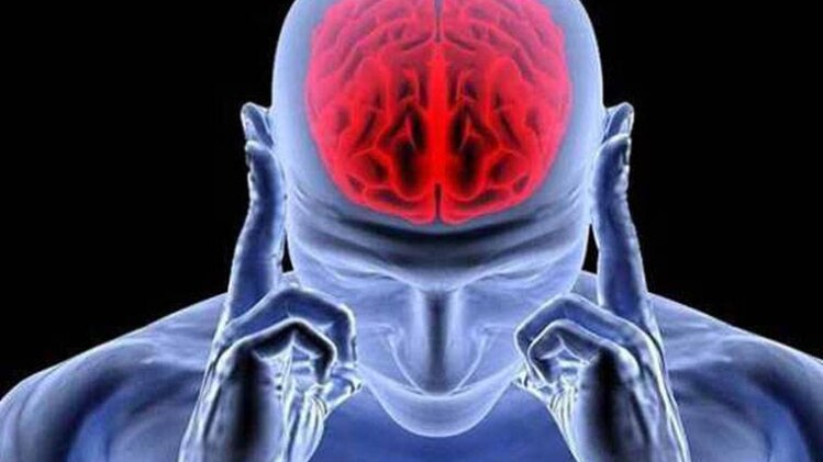 अल्जाइमर