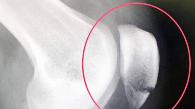 प्रतीकात्मक फोटो