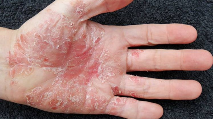 प्रतीकात्मक फोटो