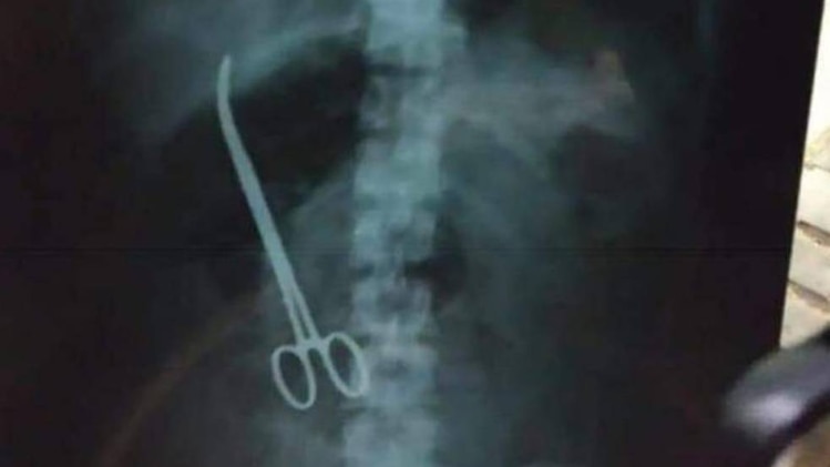 एक्स-रे रिपोर्ट