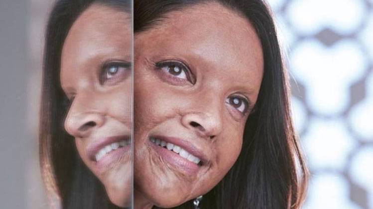 छपाक एसिड अटैक सर्वाइवर लक्ष्मी अग्रवाल की कहानी है. 