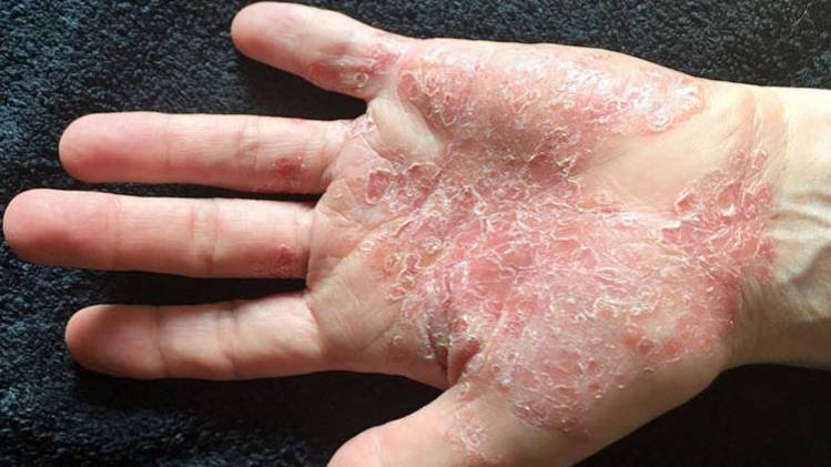 प्रतीकात्मक फोटो