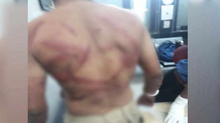 पुलिस द्वारा पिटाई के बाद जख्म दिखाता सरदार 