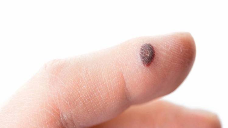 प्रतीकात्मक फोटो