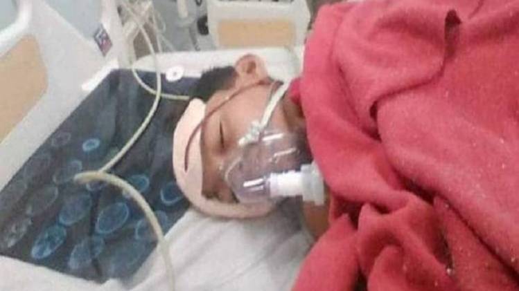 घायल बच्चा