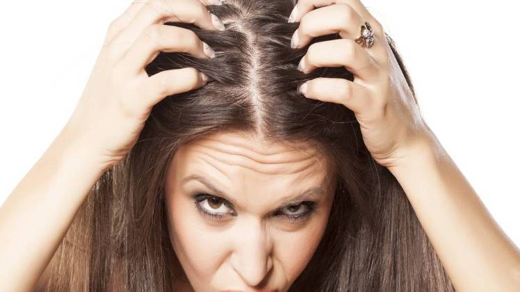 मॉनसून में लोग डैंड्रफ से काफी ज्यादा परेशान रहते हैं.