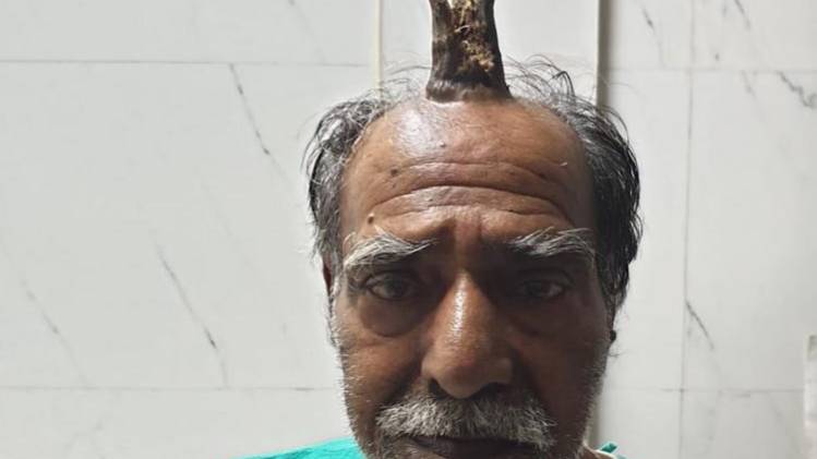 भोपाल के श्याम लाल यादव इस समस्या से काफी दिनों से परेशान थे. (फोटो-आजतक)