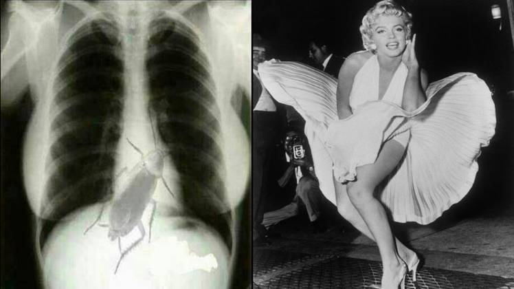 मर्लिन मुनरो के एक्स-रे की वायरल फोटो