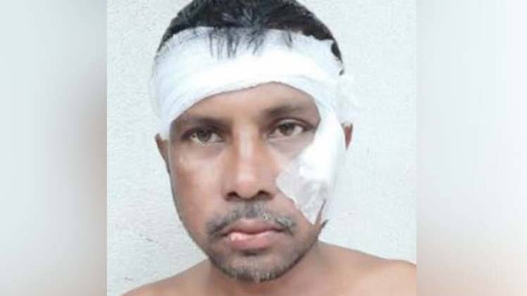 घायल रणजीत मंडल (फोटोः ANI_)