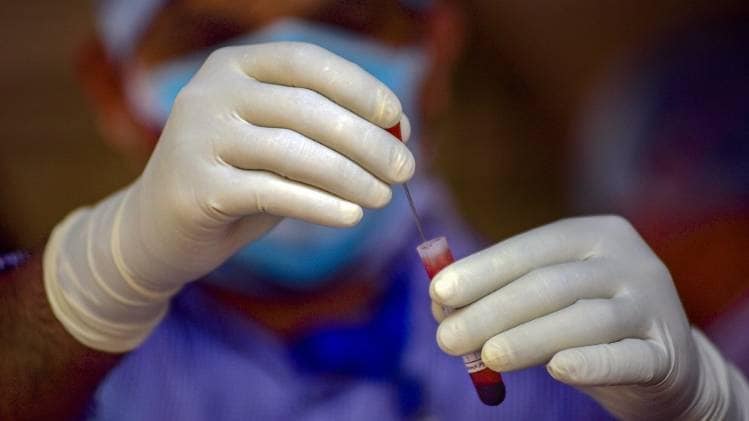 कोरोना रैपिड टेस्ट किट (फाइल फोटो-PTI)