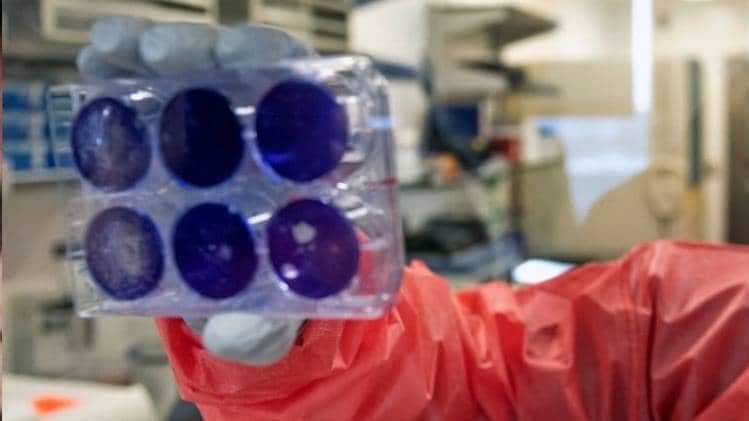 कोरोना के लिए वैक्सीन विकसित करने में जुटी दुनिया (फोटो- PTI)