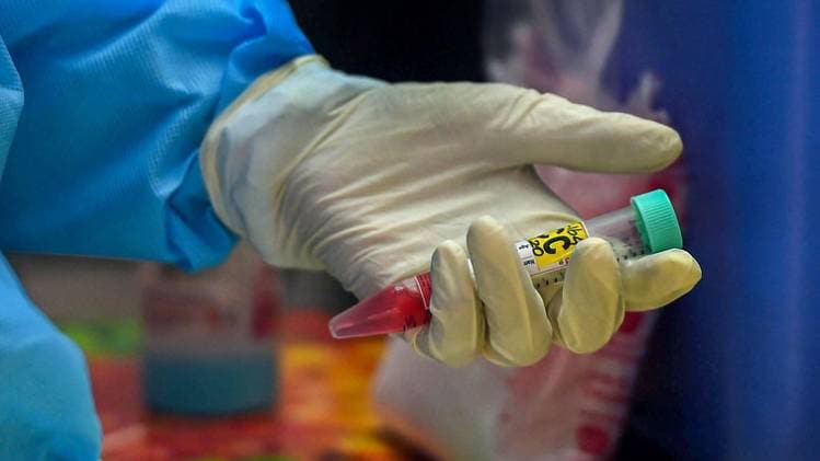 कोरोना के इलाज के लिए कोशिशों का दौर जारी (फाइल-पीटीआई)