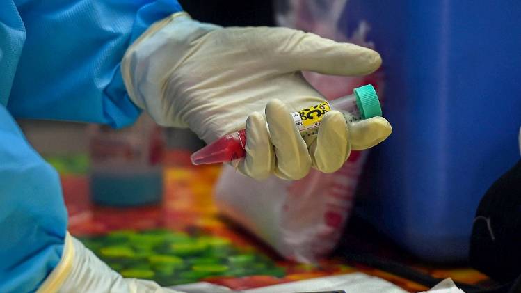 सांकेतिक तस्वीर