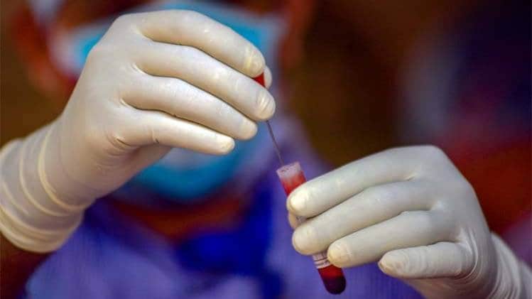 चीन से दुनिया में फैला कोरोना वायरस (प्रतीकात्मक तस्वीर-PTI)