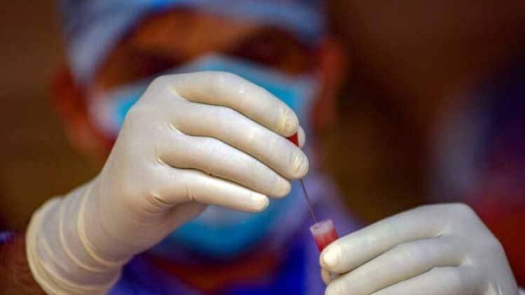 बिहार में कोरोना टेस्टिंग की रफ्तार धीमी (फाइल फोटो)