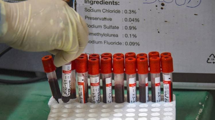 सांकेतिक तस्वीर