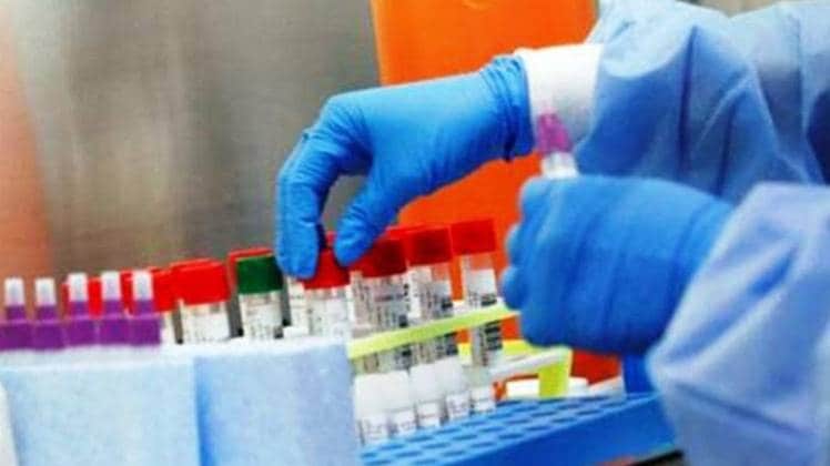 कोरोना जांच (प्रतीकात्मक फोटो- Aajtak)