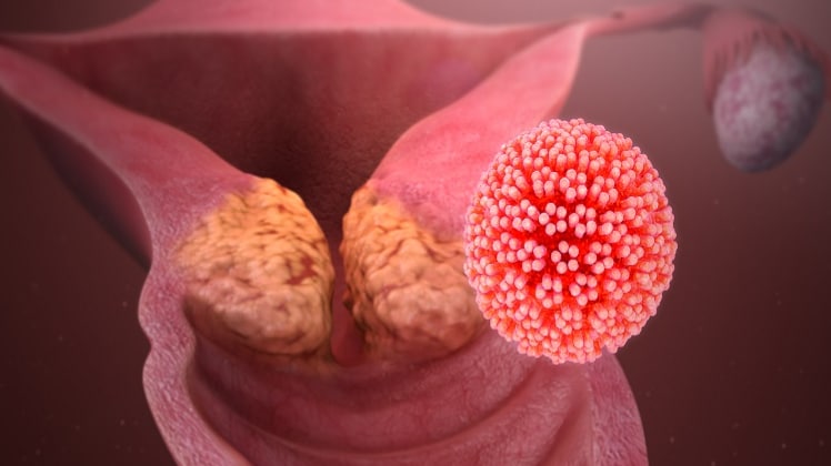 PanSeer नाम का यह ब्लड टेस्ट 95 प्रतिशत लोगों में कैंसर का पता लगा सकता है.