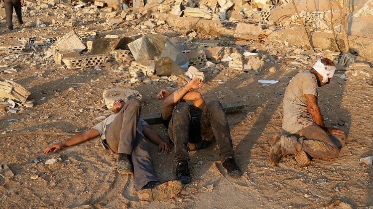 बेरूत धमाके में घायल लोग (फोटो-AP)