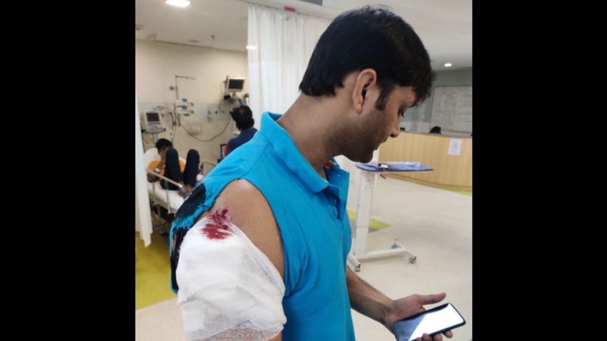 इंस्पेक्टर पर चलाई गोली (फोटो- आजतक)