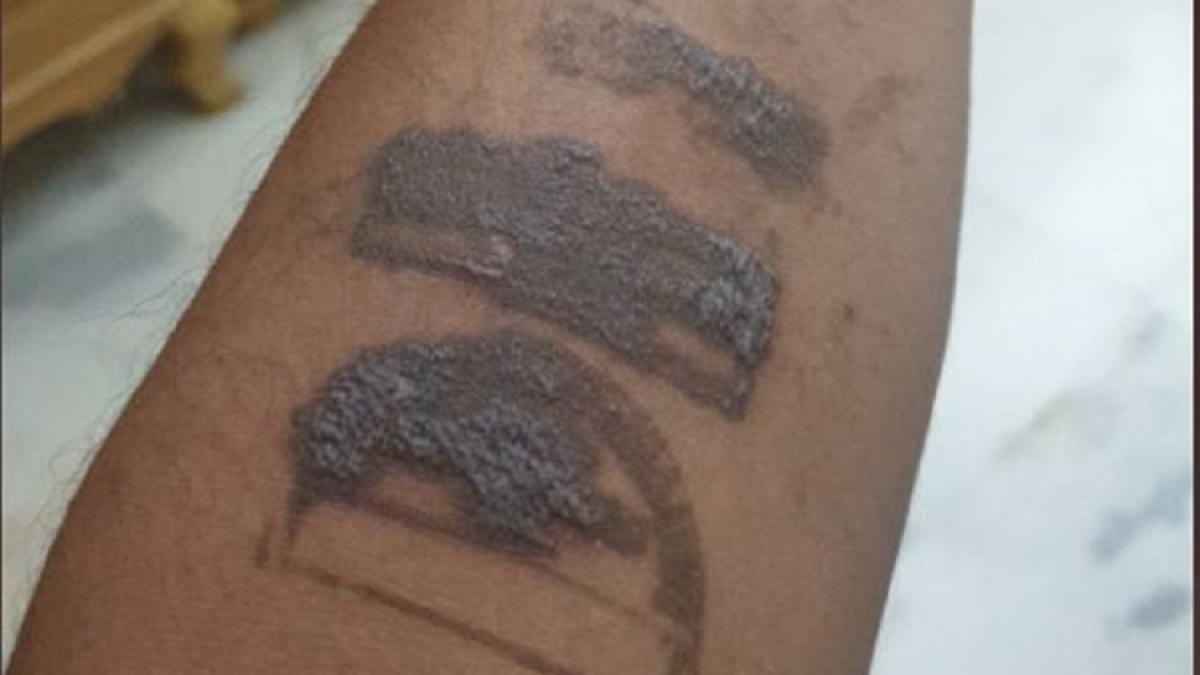 कांग्रेस नेता के हाथ पर बना निशान (फोटो-ट्विटर)