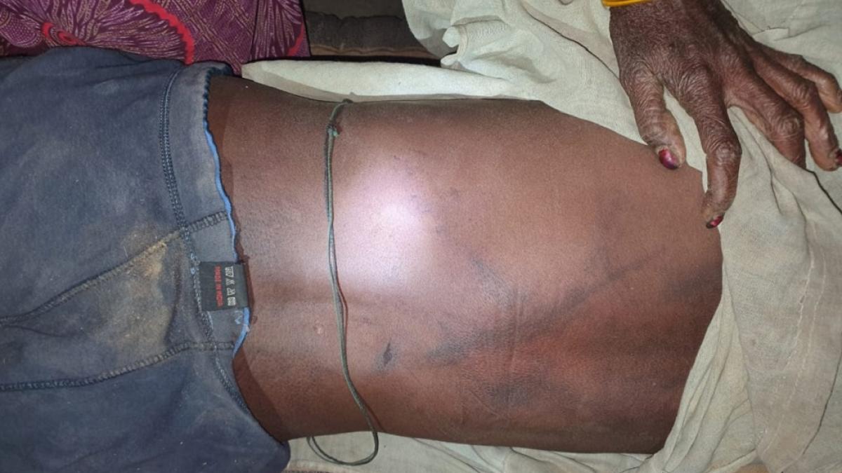 मृतक के शरीर पर चोट के कई निशान थे