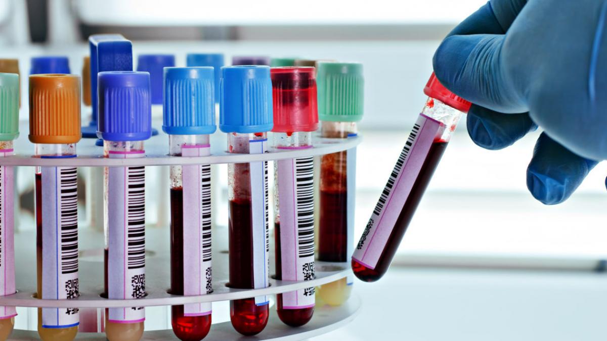 सांकेतिक तस्वीर