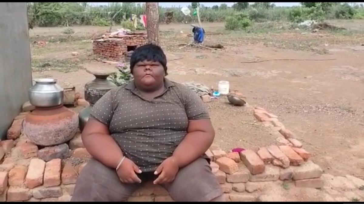 अमरेली के धारी का रहने वाला 13 साल का सागर वजन 140 किलो