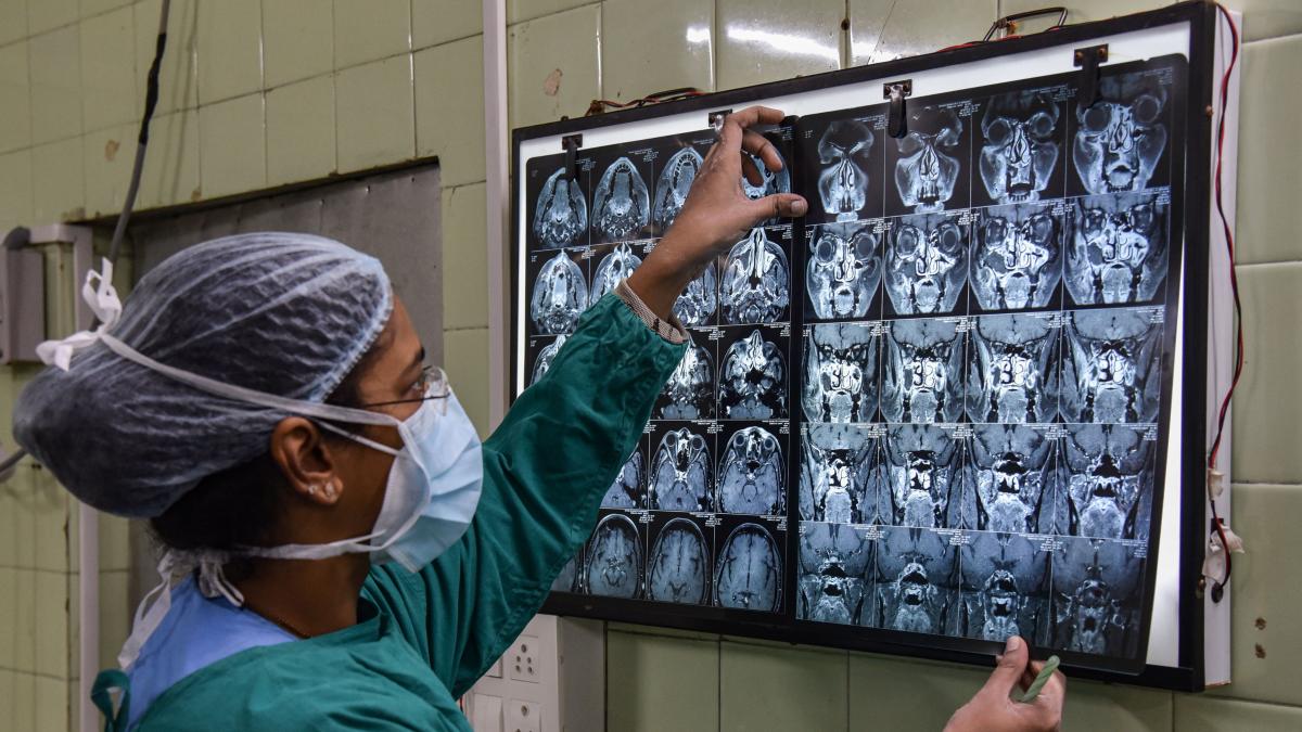 देश में ब्लैक फंगस का संकट चिंताजनक (फोटो-PTI)