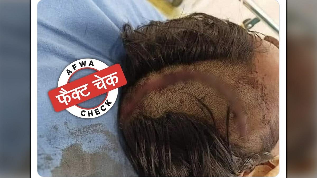 सोशल मीडिया पर वायरल हो रही है तस्वीर.