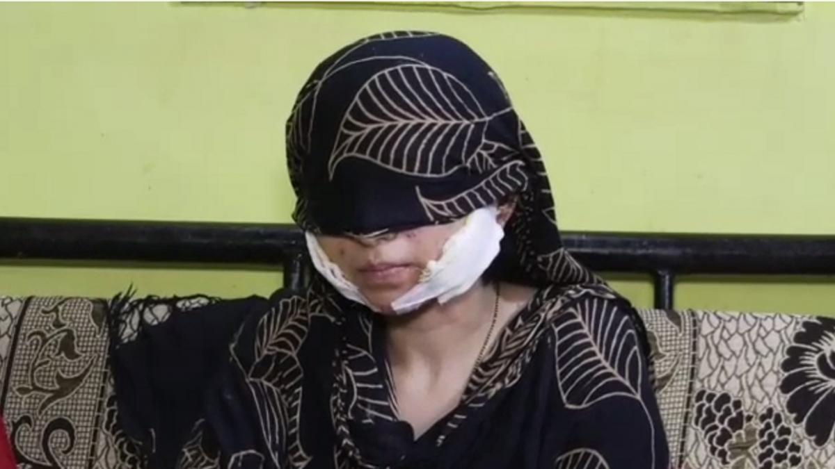 युवती पर सिरफिरे आशिक ने किया हमला